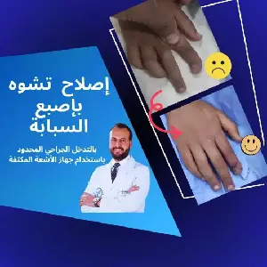 إصلاح تشوه الاصابع